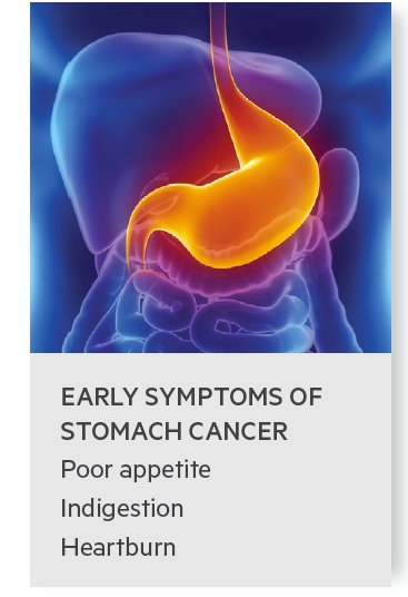 early symptoms of stomach cancer include poor appetite, indigestion and heartburn