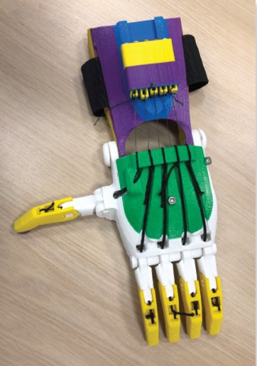 A working prototype of a prosthesis                 from a 3D printer